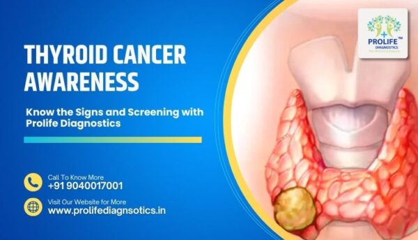 Thyroid Cancer Awareness Know the Signs and Screening with Prolife Diagnostics