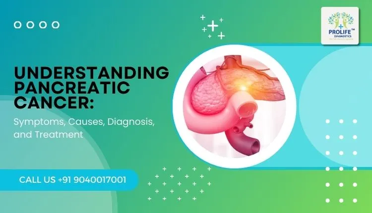 Understanding Pancreatic Cancer - Prolife Diagnostics