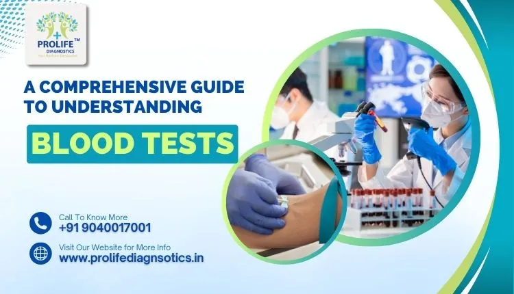 A Comprehensive Guide on Blood Tests at Prolife Diagnostics