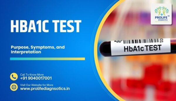 All about HbA1c Test Purpose, Symptoms, and Interpretation