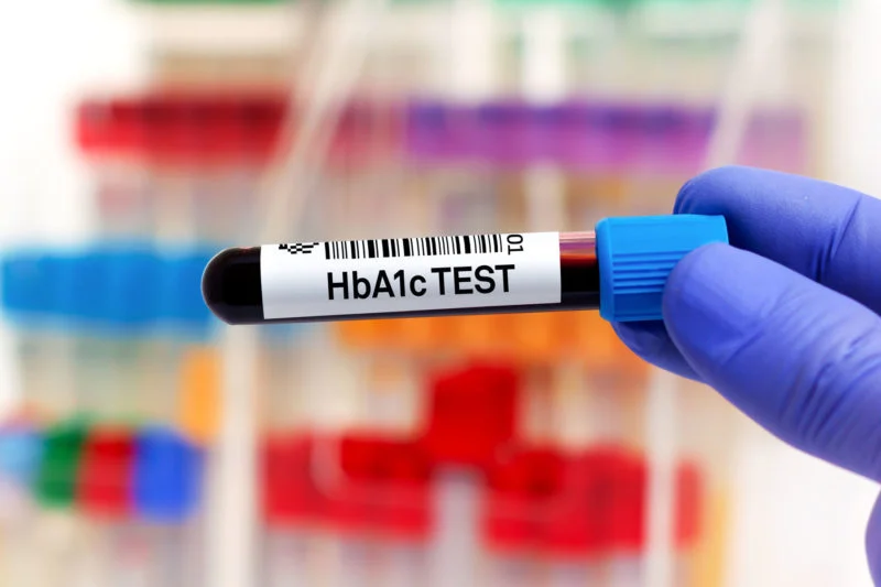 All about HbA1c Test in Bhubaneswar