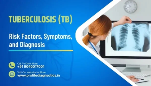 Tuberculosis (TB) Risk Factors, Symptoms, and Diagnosis