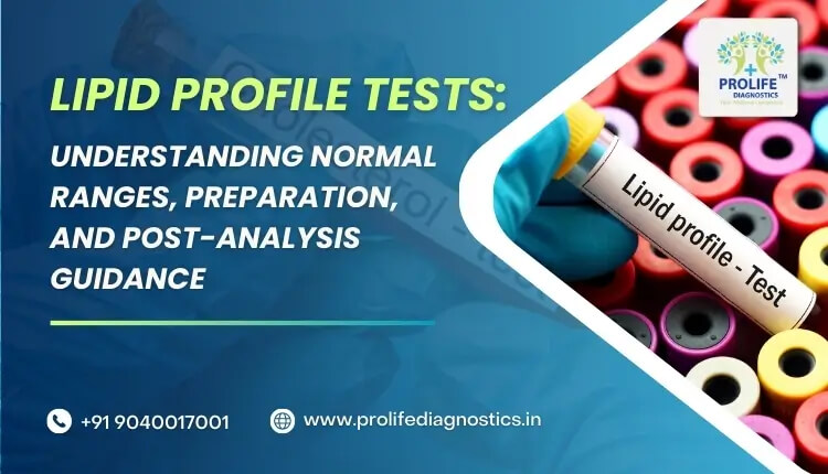 Lipid Profile Tests Understanding Normal Ranges, Preparation, and Post-Analysis Guidance