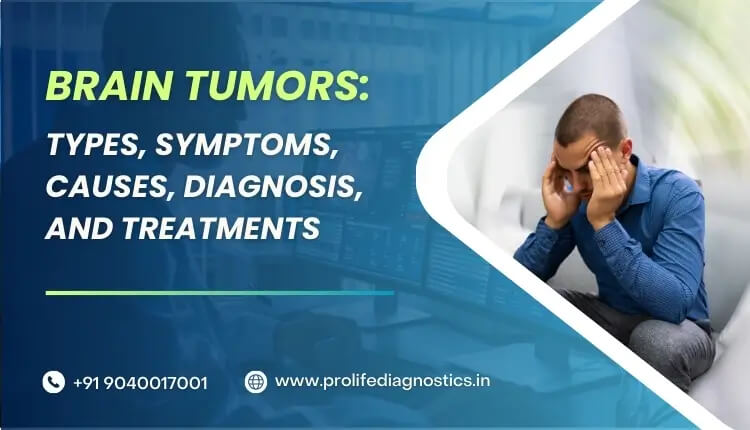 All About Brain Tumors Types, Symptoms, Causes, Diagnosis, and Treatments