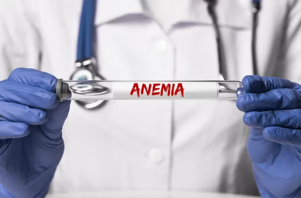Anemia Profile
