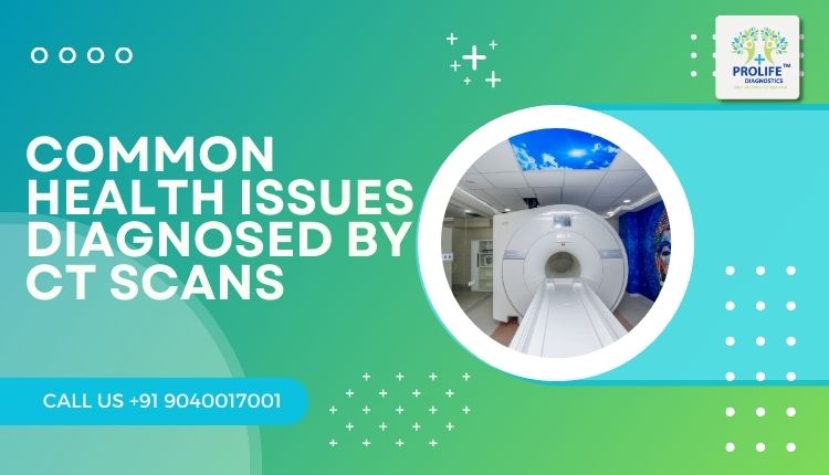 Common Health Issues Diagnosed by CT Scans