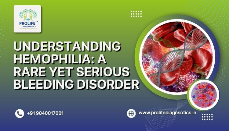 Understanding Hemophilia A Rare Yet Serious Bleeding Disorder