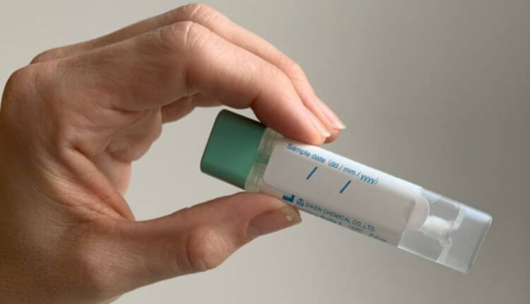 Colorectal Cancer Screening (Colonoscopy or FIT Test)