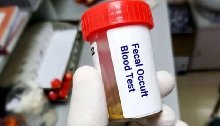 Colorectal Cancer Screening
