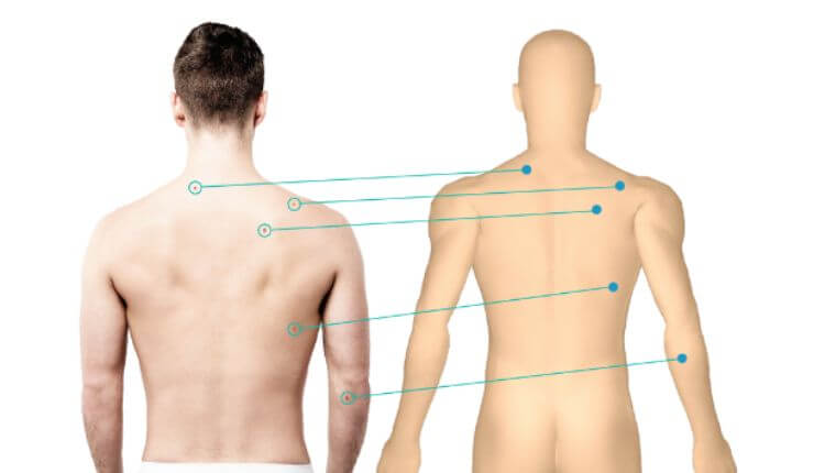 Skin Cancer Check