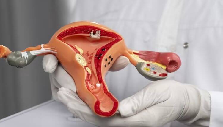 cervical cancer screening (pap smear & hpv test)