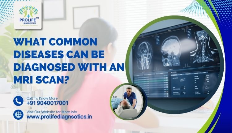 What Common Diseases Can Be Diagnosed with an MRI Scan