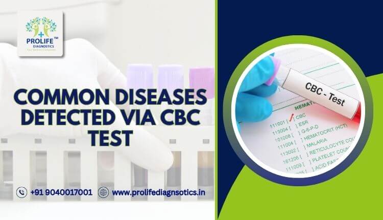 Common Diseases Detected Via CBC Test