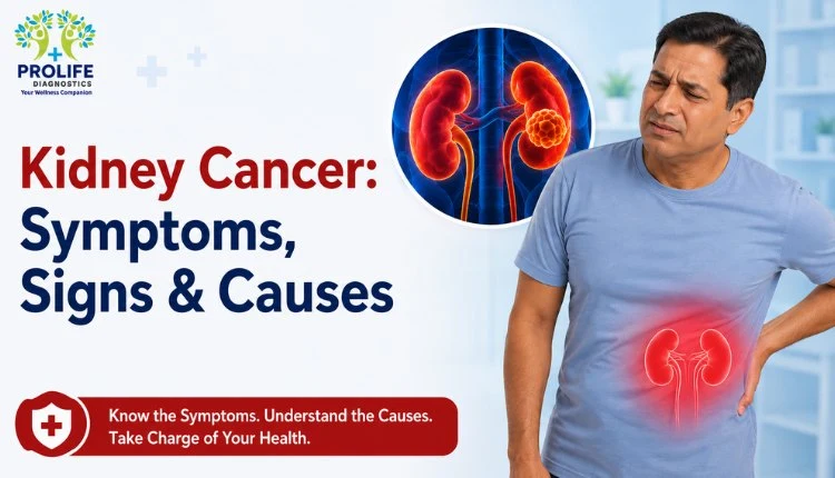 Early Warning Signs of Kidney Cancer Explained
