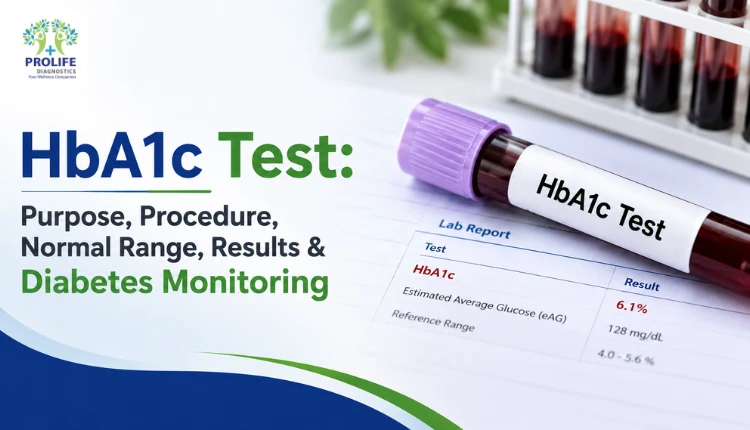 Understanding HbA1c Test Results and Diabetes Monitoring